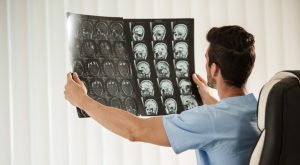 How Do Neurosurgeon Salaries in the UK Compare to Global Standards